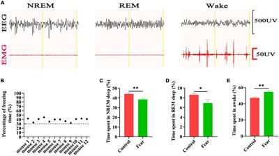 Neural pathways from hypothalamic orexin neurons to the ventrolateral preoptic area mediate sleep impairments induced by conditioned fear
